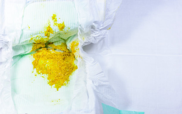 脏尿布图片下载