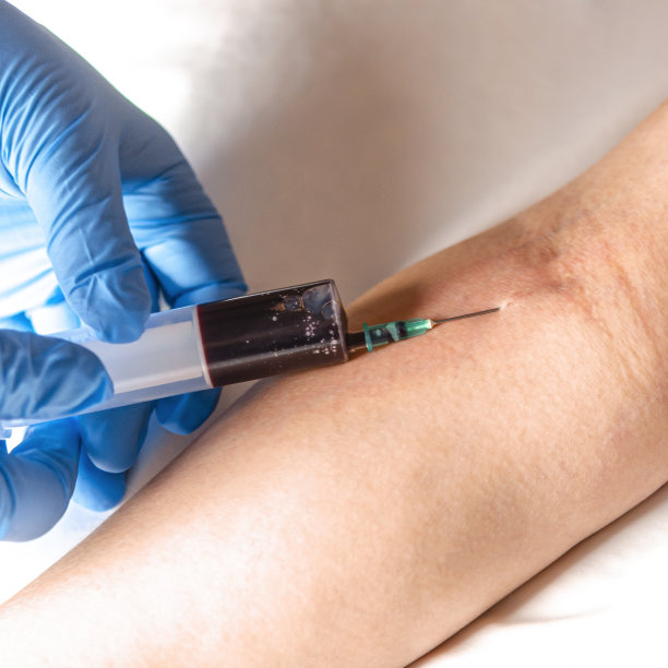 医院。静脉血取样用于医院分析。健康图片下载