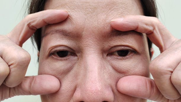 松弛、脂肪下垂、视力问题。图片下载