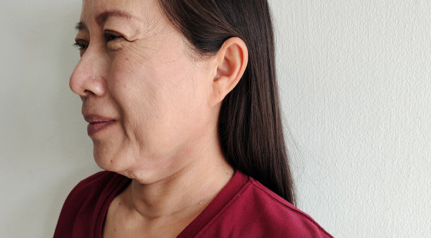 颈部下方的松弛、脂肪下垂和松弛的皱纹。图片下载