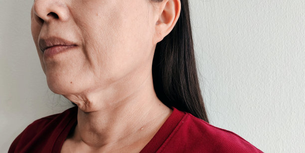 颈部下方的松弛、脂肪下垂和松弛的皱纹。图片下载