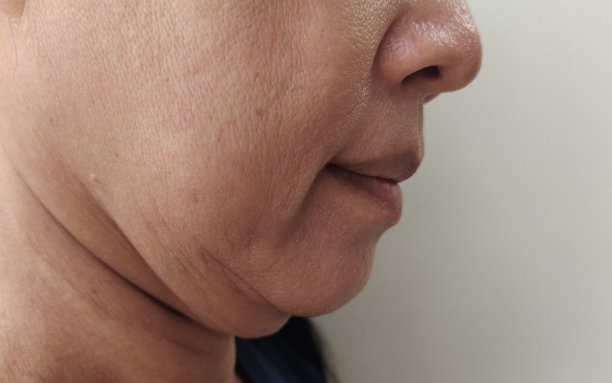 颈部下方的松弛、脂肪下垂和松弛的皱纹。图片下载