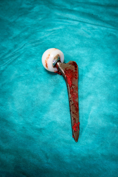 移植的髋关节假体躺在手术台上图片下载