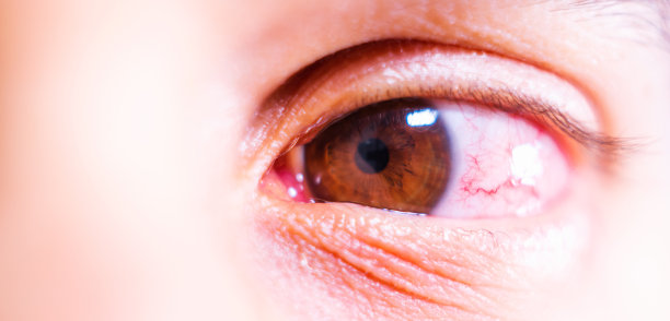 棕色眼睛的详细照片具有视觉不适，健康和眼部护理主题，皮肤纹理图片下载