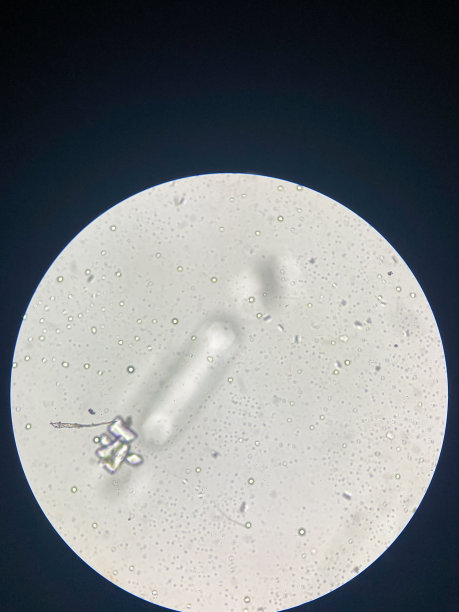 尿液沉渣中鸟粪石结晶的显微镜观察：磷酸铵镁结晶，引起猫下泌尿道疾病图片下载
