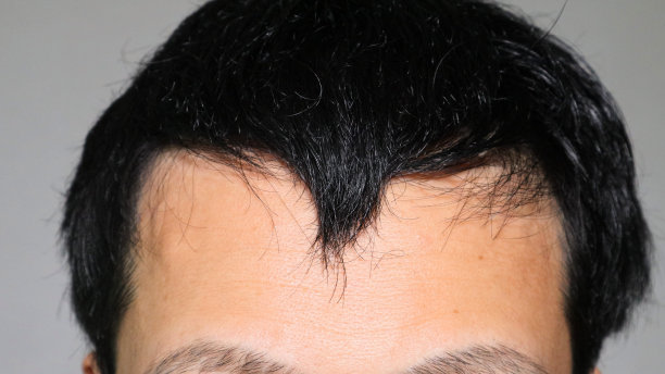 头发稀疏的日本男人图片下载