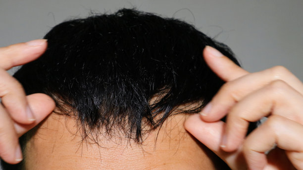 一个头发稀疏的男人图片下载