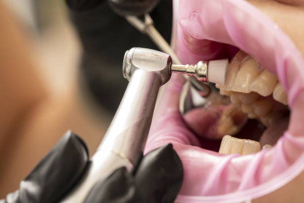 牙齿抛光图片下载