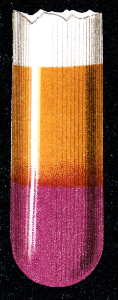 尿液中碘化钾的药物检测- 19世纪图片下载