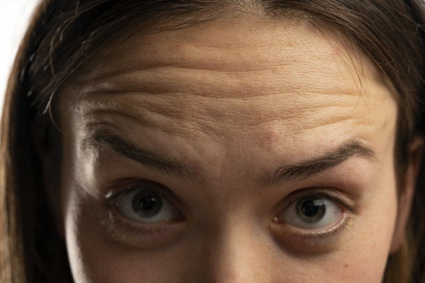 年轻的白人女性额头皱纹特写图片下载