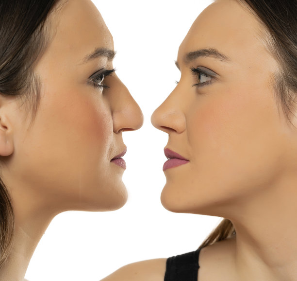 女性整容前后的脸部对比图图片下载