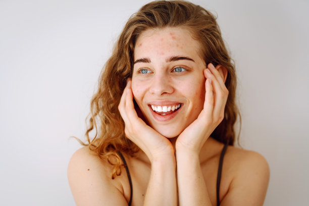 一个美丽的年轻女子的肖像，脸上有炎症。医学和美容。图片下载