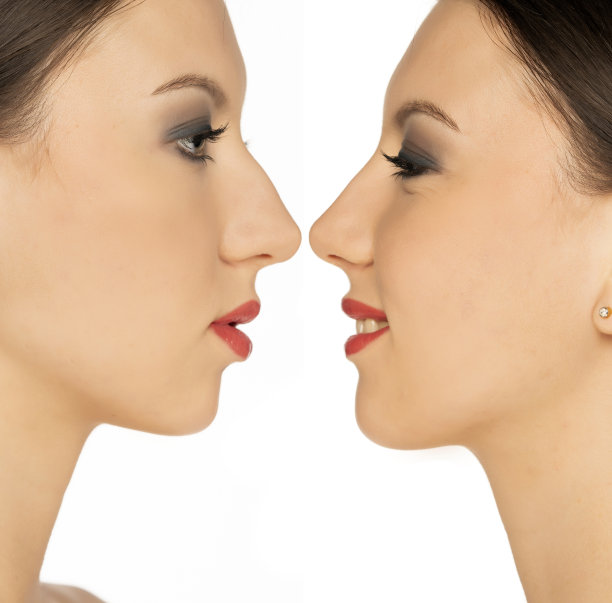 一位年轻女子，整形手术前后的鼻子图片下载