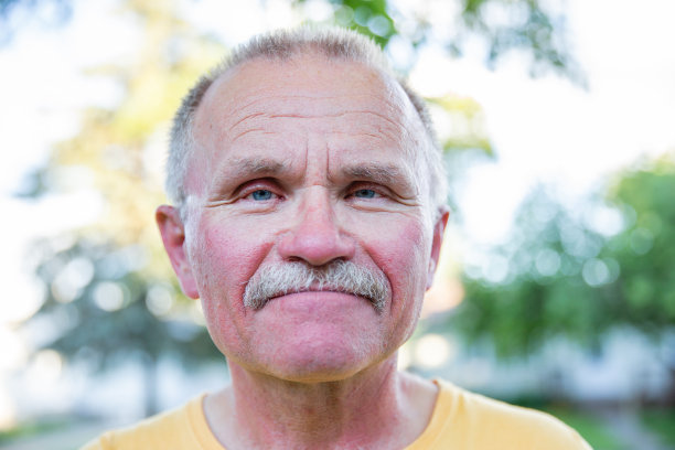 脸部晒伤的男子头部照片图片下载