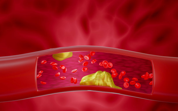 医学模拟血管中的血块或脂肪块。吃高脂肪食物和不运动的健康问题血液中毒素的积累。三维渲染图片下载