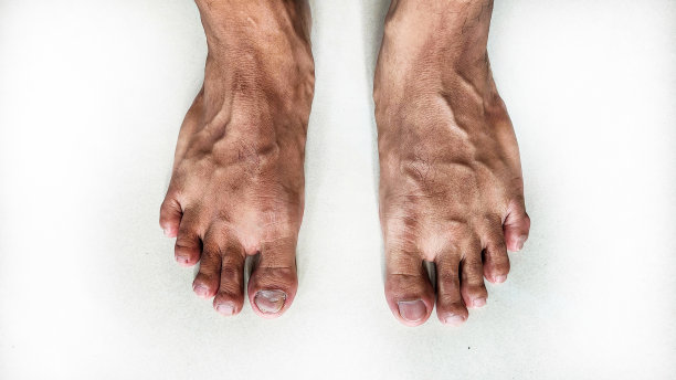 工人脚的一种形式图片下载