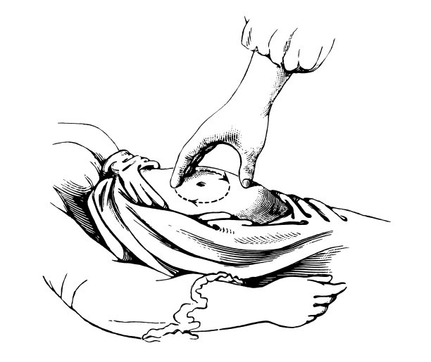 按摩以刺激蠕动图片下载