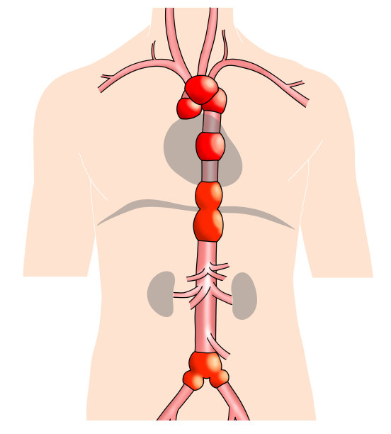 从颈部到腰部的简单主动脉示意图图片下载
