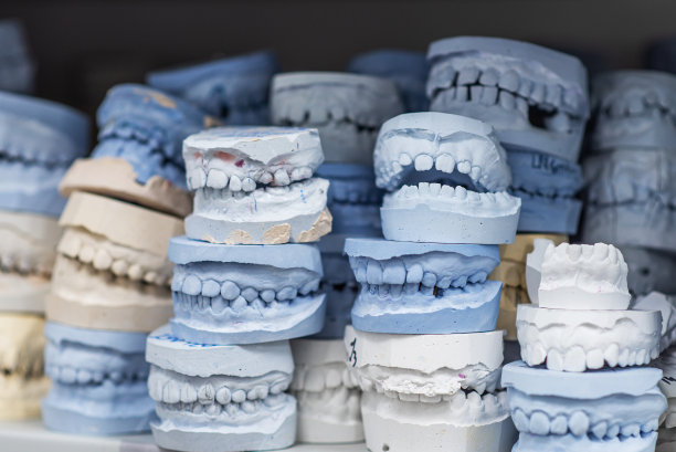 在一个正畸诊所的人类颌骨石膏模型仓库。矫正器的控制和诊断牙模。图片下载