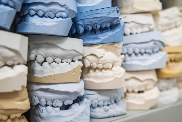 在一个正畸诊所的人类颌骨石膏模型仓库。矫正器的控制和诊断牙模。图片下载