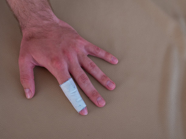 一名男子用灰泥覆盖受损部位的手指。图片下载