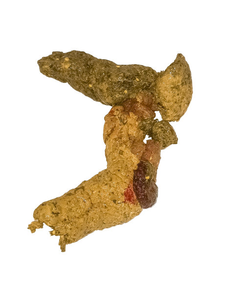 人类粪便白色背景，真正的人类粪便，便便图片下载