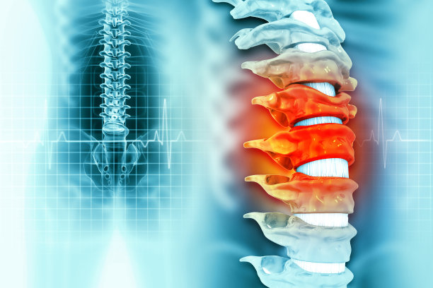 人体脊髓损伤，背部疼痛，背景模糊。三维演示图片下载