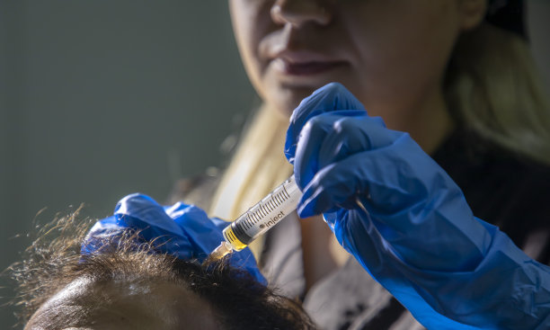 一位年轻的医生正在给她的男病人的头发做prp图片下载