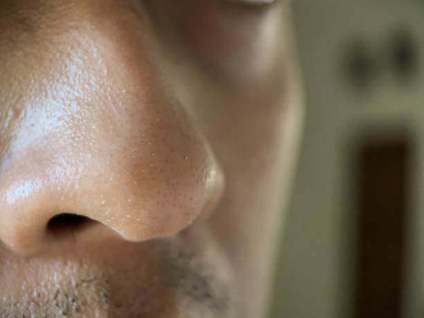 男性鼻子毛孔粗大，白头图片下载