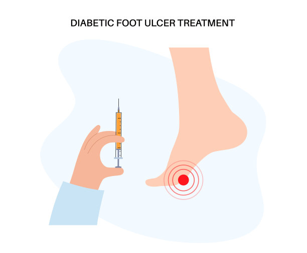 糖尿病足溃疡图片下载