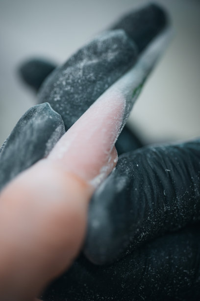 修指甲的治疗图片下载