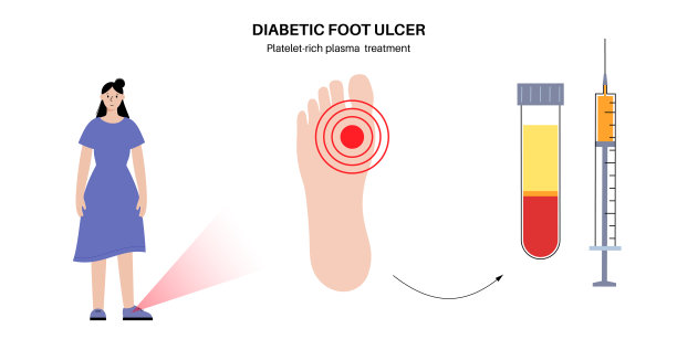 糖尿病足溃疡图片下载
