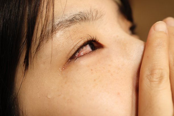 一个眼睛充血、泪流满面的女人。图片下载