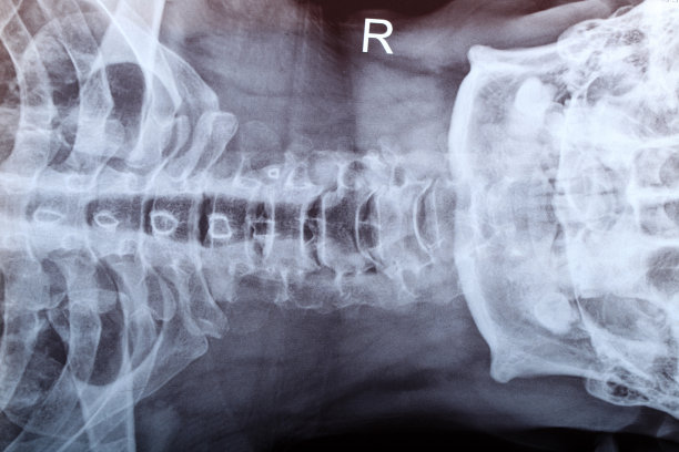 x光下的人体脊柱图片下载
