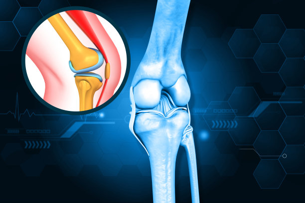 膝关节置换术的人体膝关节解剖图片下载