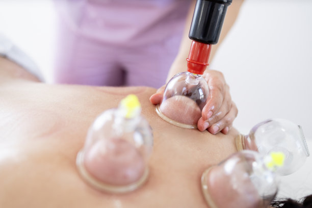 Hijama替代药物治疗慢性疼痛缓解和放松。专注于真空杯子。图片下载