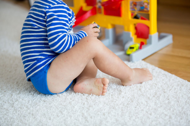 儿童手足口病图片下载