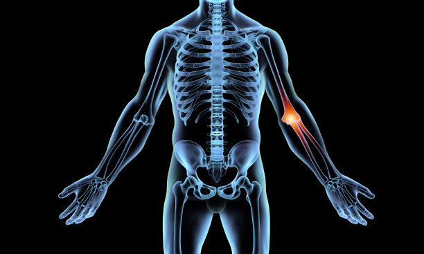 x光肘关节痛图片下载