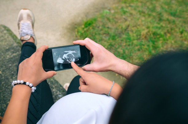 和她的夫妇在电话上看怀孕的超声波扫描图片下载