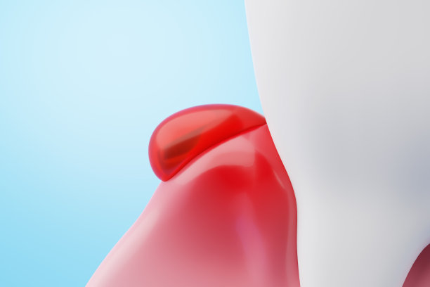 牙龈出血缝合图片下载