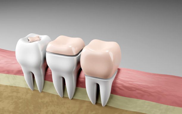 用不同类型的牙齿补牙，口腔卫生和牙齿检查牙齿。医疗牙医工具，儿童保健，3d渲染图片下载