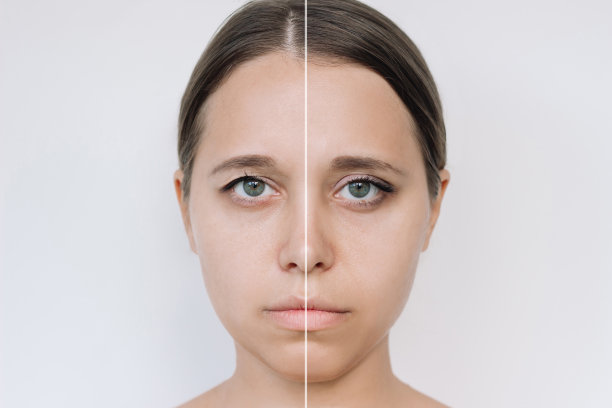 年轻漂亮的白人女性的脸，上眼睑下垂，前后眼睑整容图片下载