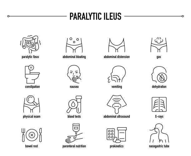 麻痹性肠梗阻矢量图标集。行编辑医学图标。图片下载
