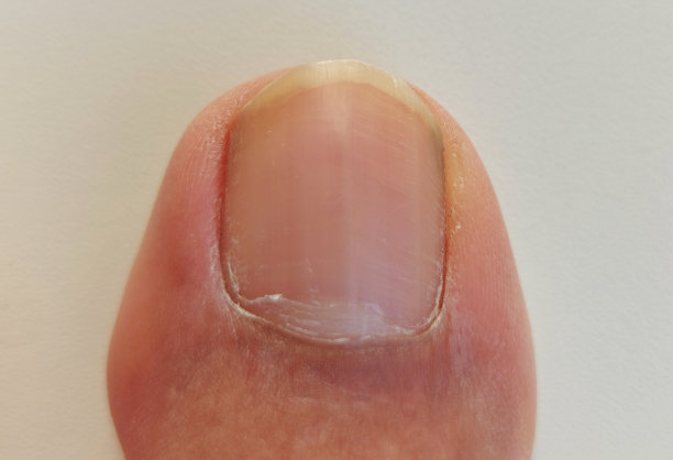 大脚趾图片下载