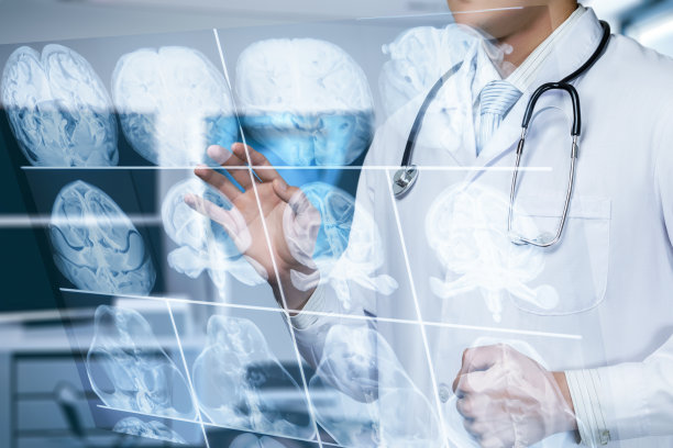 利用大脑x射线图像进行诊断和治疗。图片下载