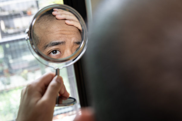 一名亚洲男子在看了小镜子后担心自己的脱发问题。图片下载