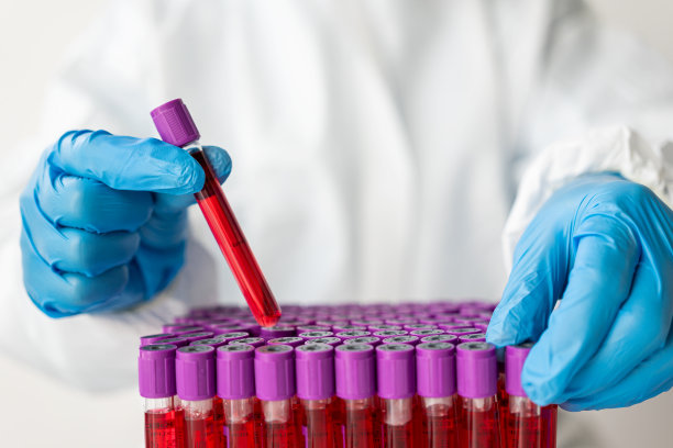 医学家化学家研究员拿着血样管做化学实验和检查病人的血样在医院的医学和研究概念的特写照片图片下载