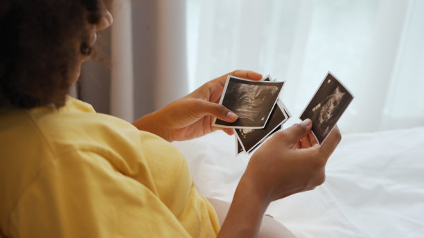 一位非裔美国孕妇正在看她的超声波扫描照片图片下载
