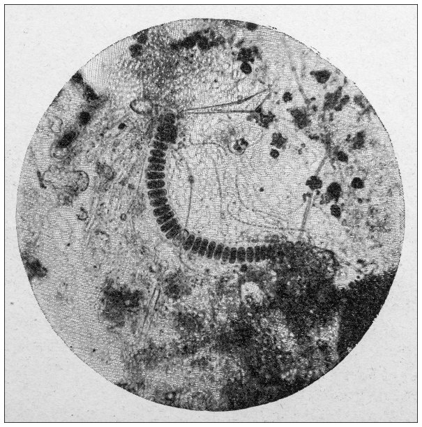 古董图:显微镜下的巴黎水图片下载