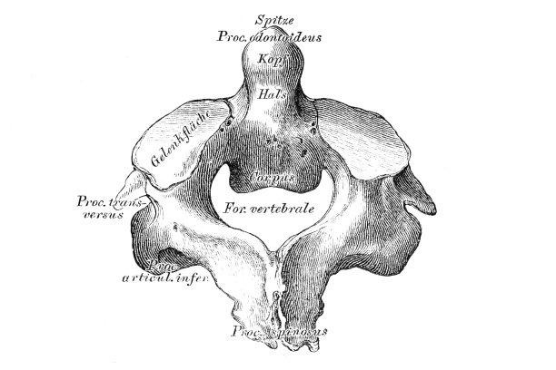 颈椎轴或枢椎体图片下载